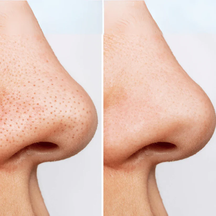 Anua Heartleaf + Enzyme Pore Clay Pack 100ml - Image 2
